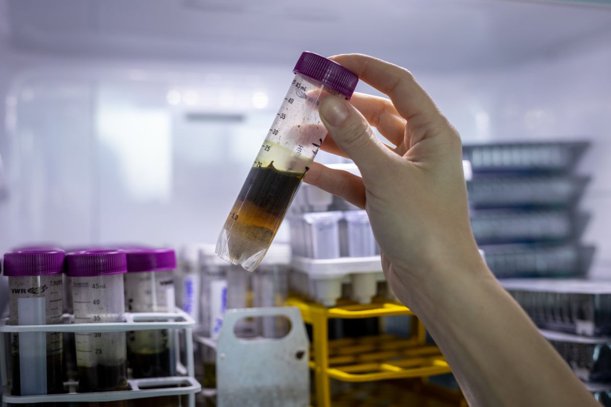 Protiparazitní léčiva nejsou pro člověka toxická. Mohou ale zabíjet v půdě volně žijící bezobratlé organismy a další živočichy jako třeba žížaly.