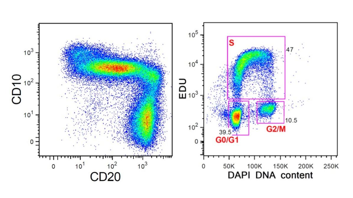 Ukázky cytometrických výsledků. Vlevo je vývoj B-lymfocytů v kostní dřeni detekovaný podle exprese znaků CD10 a CD20. Vpravo je zobrazena analýza proliferace (množení) bílých krvinek detekovaná podle množství DNA.