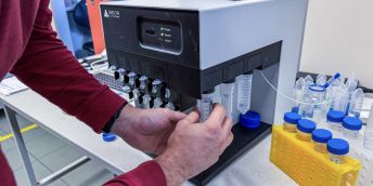 Unikátní systém využívá jen pět pracovišť po celém světě. Ostravská univerzita je jedním z nich.