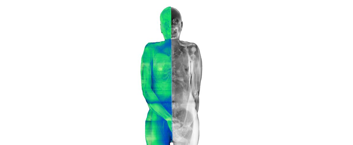 Antropometrické vyšetření a celotělové 3D skenováním poskytne výzkumníkům přesné údaje o velikosti a tvaru těla obyvatel. Magnetickou rezonancí pak budou zjišťovat vnitřní složení těla a distribuci tělesného tuku.